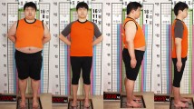 [-50kg 감량사례] 3개월 20일 만에 '총 -50kg감량'으로 치명적 비만성 고혈압 완치!