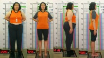 [ -47kg 감량사례 ] 여성 초고도비만 치료사례