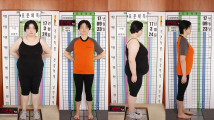 '악성 요요' 여성 초고도비만 -45kg 감량성공!